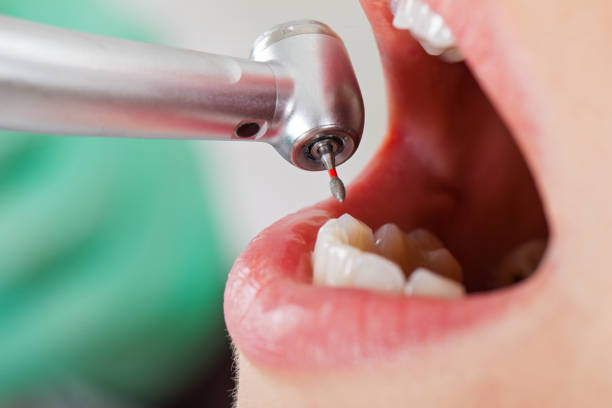 Best Dental Abscess Treatment in Portland, MI